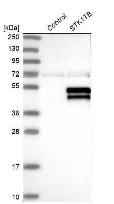 Western Blot: DRAK2 Antibody [NBP1-84980]