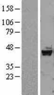 Western Blot: DRAK2 Overexpression Lysate [NBL1-16544]