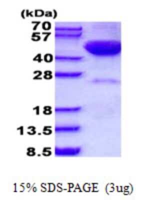 SDS-PAGE: Recombinant Human DRAK2 His Protein [NBP2-23462]