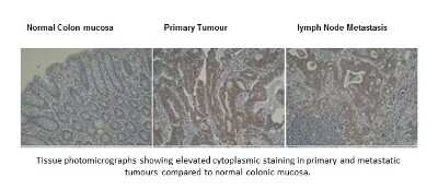 Immunohistochemistry: DRAM Antibody (M3-P4B4) - BSA Free [NBP2-50379]