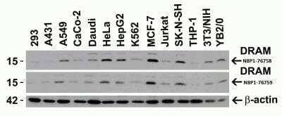 Western Blot: DRAM AntibodyBSA Free [NBP1-76759]