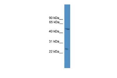 Western Blot: DRAM Antibody [NBP2-88807]