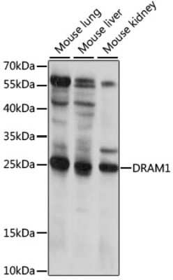 Western Blot: DRAM AntibodyAzide and BSA Free [NBP2-92236]