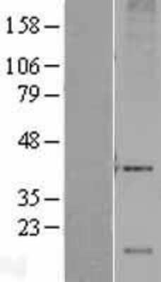 Western Blot: DRAM Overexpression Lysate [NBP2-04372]