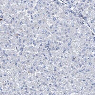 Immunohistochemistry-Paraffin: DRAM2 Antibody [NBP1-93463]