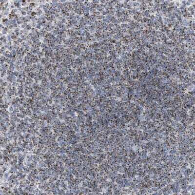 Immunohistochemistry-Paraffin: DRAM2 Antibody [NBP1-93463]