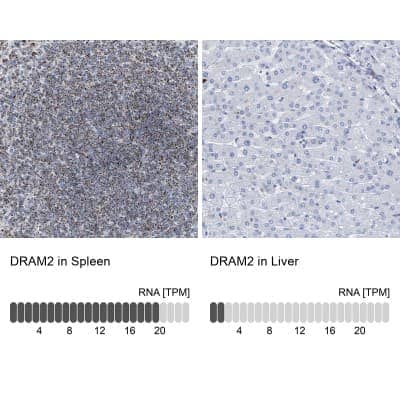 Immunohistochemistry-Paraffin: DRAM2 Antibody [NBP1-93463]