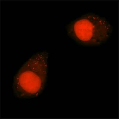 Live Imaging Microscopy: DRAQ5 (TM) [NBP2-81125]