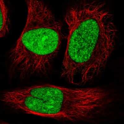 Immunocytochemistry/ Immunofluorescence: DRB1 Antibody [NBP1-87966]