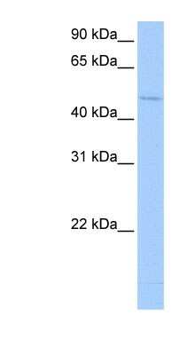 Western Blot: DRB1 Antibody [NBP1-80481]