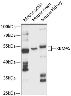 Western Blot: DRB1 AntibodyAzide and BSA Free [NBP2-92131]