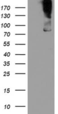 Western Blot: DREF Antibody (OTI5A2) [NBP2-46383]