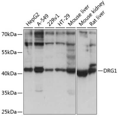 Western Blot: DRG1 AntibodyAzide and BSA Free [NBP2-92437]