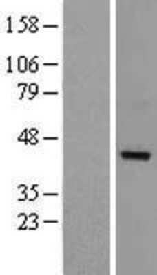 Western Blot: DRG1 Overexpression Lysate [NBL1-10020]