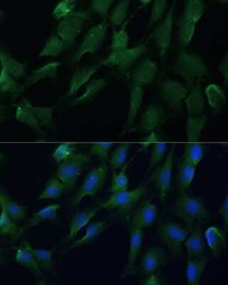 Immunocytochemistry/ Immunofluorescence: DRG2 Antibody - Azide and BSA Free [NBP2-92638]