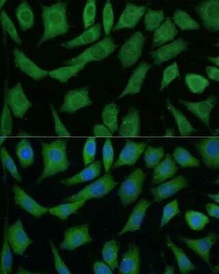 Immunocytochemistry/ Immunofluorescence: DRG2 Antibody - Azide and BSA Free [NBP2-92638]