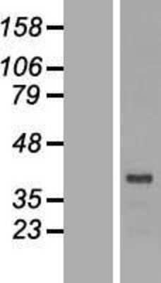 Western Blot: DRG2 Overexpression Lysate [NBL1-10021]