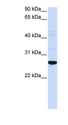 Western Blot: DRGX Antibody [NBP1-91316]