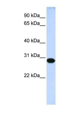 Western Blot: DRGX Antibody [NBP1-91317]