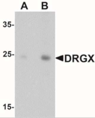 Western Blot: DRGX AntibodyBSA Free [NBP2-41138]