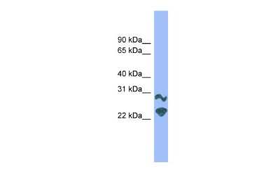 Western Blot: DRGX Antibody [NBP3-10461]