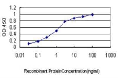 ELISA: DRIL1 Antibody (1A11) [H00001820-M01]