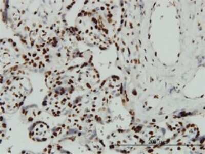 Immunohistochemistry-Paraffin: DRIL1 Antibody (1A11) [H00001820-M01]