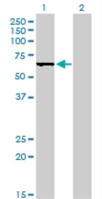Western Blot: DRIL1 Antibody (1A11) [H00001820-M01]