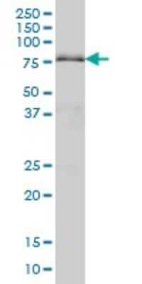 Western Blot: DRIL1 Antibody (1A11) [H00001820-M01]