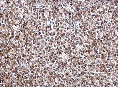 Immunohistochemistry-Paraffin: DRIL1 Antibody [NBP2-16228]