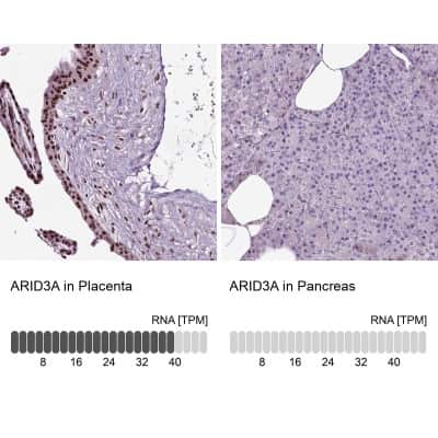 Immunohistochemistry-Paraffin: DRIL1 Antibody [NBP2-62705]
