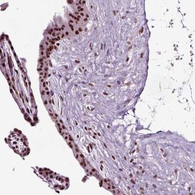 Immunohistochemistry-Paraffin: DRIL1 Antibody [NBP2-62705]