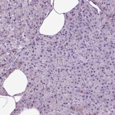 Immunohistochemistry-Paraffin: DRIL1 Antibody [NBP2-62705]