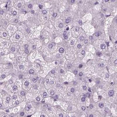 Immunohistochemistry-Paraffin: DRIL1 Antibody [NBP2-62705]