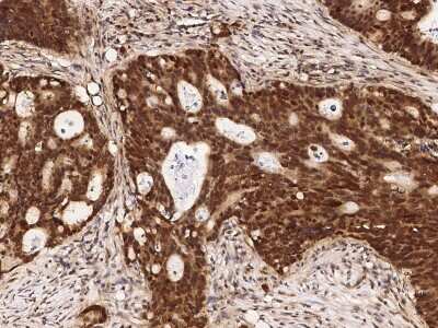 Immunohistochemistry-Paraffin: DRIL1 Antibody [NBP2-98981]