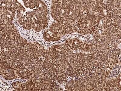 Immunohistochemistry-Paraffin: DRIL1 Antibody [NBP2-98981]