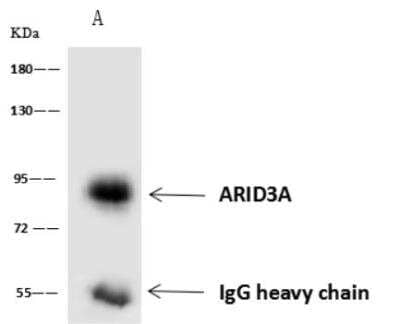 Immunoprecipitation: DRIL1 Antibody [NBP2-98579]