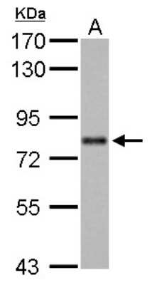 Western Blot: DRIL1 Antibody [NBP1-31418]