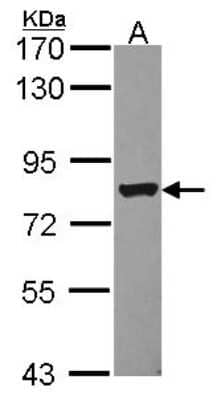 Western Blot: DRIL1 Antibody [NBP2-16228]