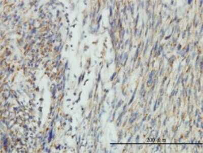 Immunohistochemistry-Paraffin: DRP1 Antibody (3B5) [H00010059-M01]