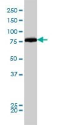 Western Blot: DRP1 Antibody (3B5) [H00010059-M01]