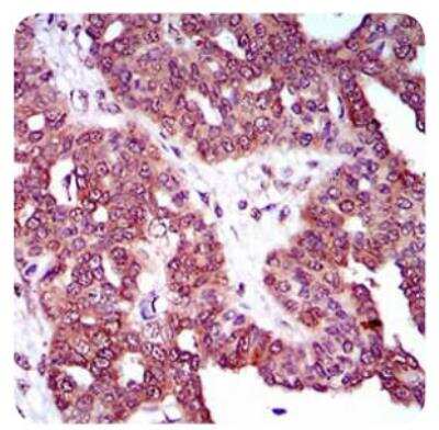 Immunohistochemistry: DRP1 Antibody (4E11B11) [NBP2-23489]