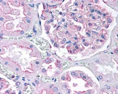 Immunohistochemistry: DRP1 Antibody - BSA Free [NB110-55288]