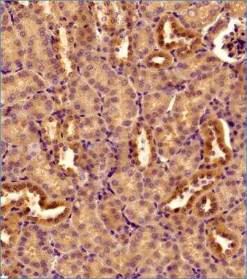 Immunohistochemistry-Paraffin: DRP1 Antibody - BSA Free [NB110-55288]