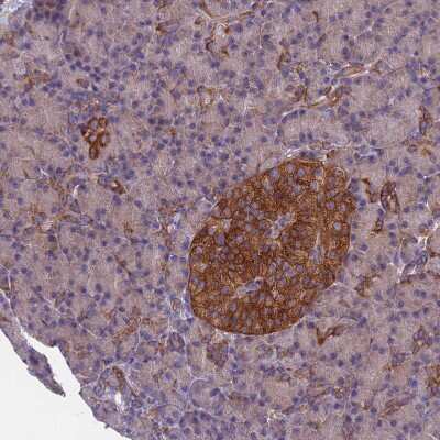 Immunohistochemistry-Paraffin: DRP1 Antibody [NBP2-34205]