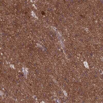 Immunohistochemistry-Paraffin: DRP1 Antibody [NBP2-34205]