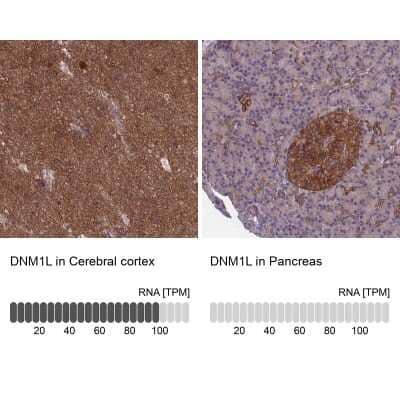 Immunohistochemistry-Paraffin: DRP1 Antibody [NBP2-34205]