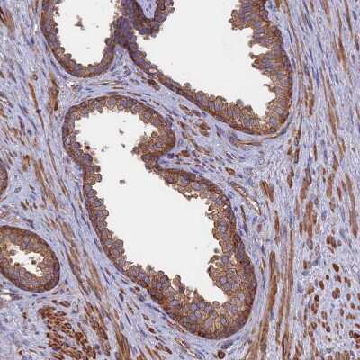 Immunohistochemistry-Paraffin: DRP1 Antibody [NBP2-34205]