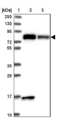 Western Blot: DRP1 Antibody [NBP2-34205]