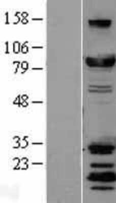 Western Blot: DRP1 Overexpression Lysate [NBL1-09966]